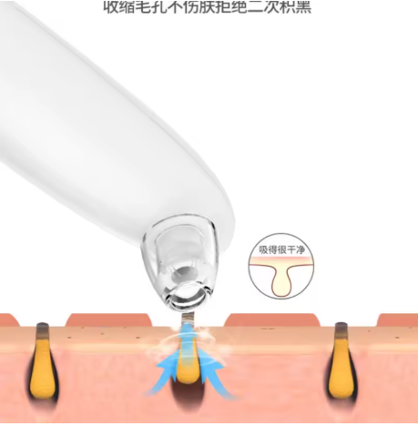 Rechargeable electric blackhead acne Black dots remover pore facial cleanser Korean skin care tag removal tool